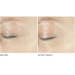 Advanced Retinol + Ferulic Triple Correction Eye Serum