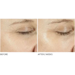 Advanced Retinol + Ferulic Triple Correction Eye Serum