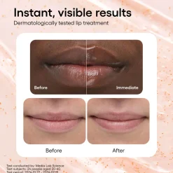 Bouncy & Firm Lip Treatment