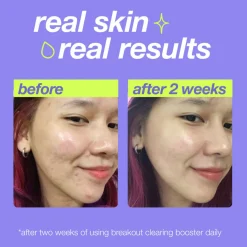 Clearance DERMALOGICA Breakout Clearing Booster