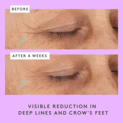 Ceramighty™ AF Eye Cream