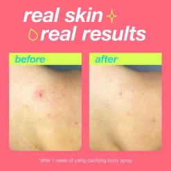 Fashion DERMALOGICA Clarifying Body Spray