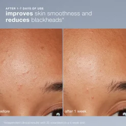 Dermalogica Daily Microfoliant