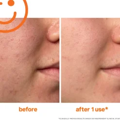 Fashion KATE SOMERVILLE ExfoliKate Intensive