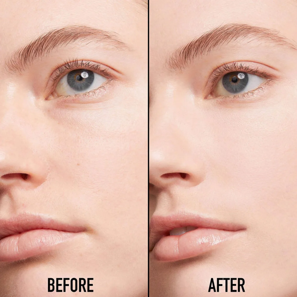 Forever Skin Correct