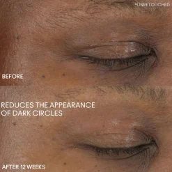 Hyper Real Serumizer Eye