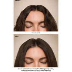 Invati Ultra Advanced™ Exfoliating Shampoo Rich