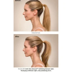 Invati Ultra Advanced™ Thickening Foam