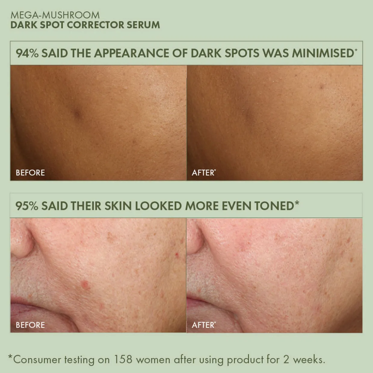 Mega-Mushroom Dark Spot Corrector Serum