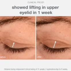 Best DERMALOGICA Phyto Nature Eye Lifting Cream