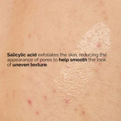 Sale THE ORDINARY Salicylic Acid 0.5% Body Serum