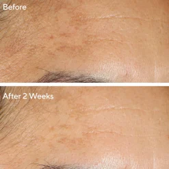 Sale MURAD Serum Vita-C Glycolic