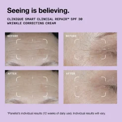 Discount CLINIQUE Smart Clinical Repair™ SPF 30 Wrinkle Correcting Cream