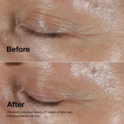 Smart Clinical Repair™ Wrinkle Correcting Eye Cream