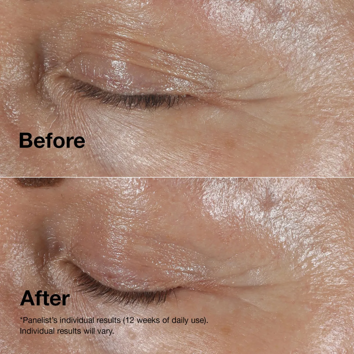 Smart Clinical Repair™ Wrinkle Correcting Eye Cream