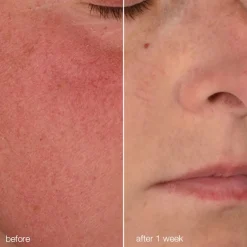 Stabilizing Repair Cream