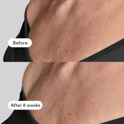 Discount TRINNY LONDON The Elevator Neck + Décolleté Concentrate