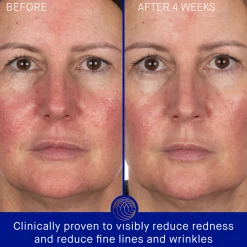 Fashion AUGUSTINUS BADER The Hydrogel Face Mask Single Sachet