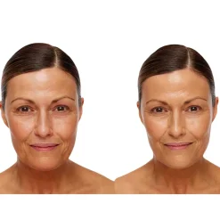 Universal Glow Treatment SPF30